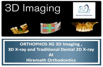 Orthophos xg 3 d imaging , 3d x ray and traditional dental 2d x-ray at hiremath orthodontics