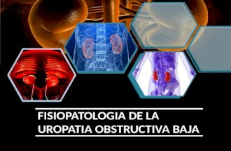 Uropatia obstructiva