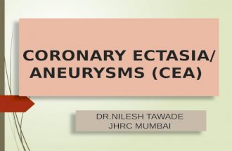Coronary ectasia