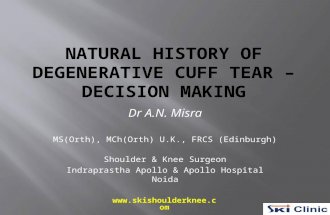 Natural History of Degenerative Cuff Tear-Decision Making-Dr A.N. Misra