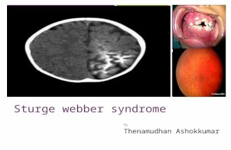 Sturge weber syndrome
