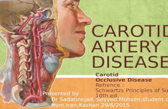Carotid artery disease, Carotid Occlusive Disease