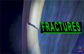 1.3.2 Fractures