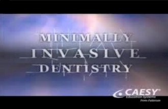 mininmal intervention dentistry