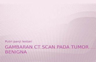 Gambaran CT Scan Pada Tumor Benigna