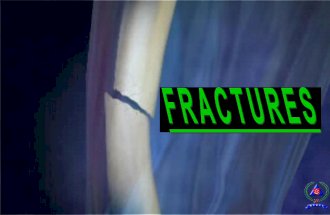 1.3.2 fractures
