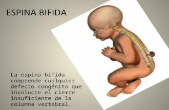 Espina Bifida Ibai
