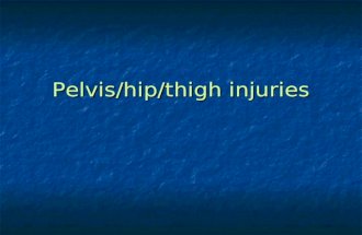 Pelvis/hip/thigh injuries. Hip Pointers Mechanism – direct blow to the iliac crest Mechanism – direct blow to the iliac crest Occurs most often in contact/collision.