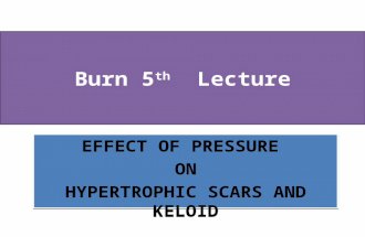 Burn 5 th Lecture EFFECT OF PRESSURE ON HYPERTROPHIC SCARS AND KELOID EFFECT OF PRESSURE ON HYPERTROPHIC SCARS AND KELOID.