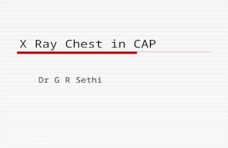 X Ray Chest in CAP Dr G R Sethi. Questions  Does it confirm pneumonia?  Is it necessary for diagnosis of CAP?  What are the radiological patterns in.