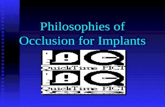 Philosophies of Occlusion for Implants. Implant Occlusion Single Crown Single Crown Fixed Partial Dentures Fixed Partial Dentures Full arch prostheses.