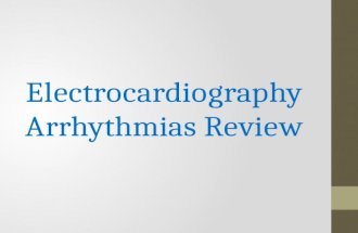 Electrocardiography Arrhythmias Review. R-R Interval to Measure HR.