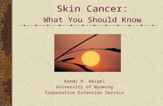 Skin Cancer: What You Should Know Randy R. Weigel University of Wyoming Cooperative Extension Service.
