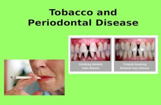 Tobacco and Periodontal Disease. What is Periodontal Disease? Periodontal Disease is also commonly known as Gum Disease This affects the gums and the.