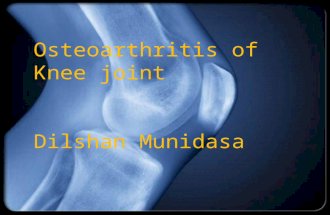 Osteoarthritis of Knee joint Dilshan Munidasa. Overview  Definition and Risk Factors  Idiopathic vs. Secondary OA  Clinical Features  Diagnosis
