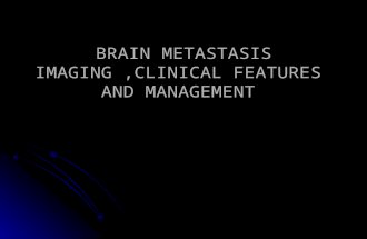 BRAIN METASTASIS IMAGING,CLINICAL FEATURES AND MANAGEMENT.