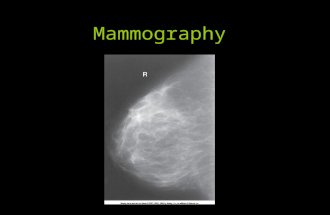 Mammography. Introduction and History Breast cancer is 2nd only to lung cancer as cause of death in women –Very treatable with early detection! 1st innovation.