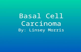 Basal Cell Carcinoma By: Linsey Morris. Description Most common form of skin cancer. Least deadly. The risk is related to the amount of sun exposure to.
