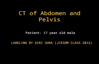 CT of Abdomen and Pelvis Patient: 17 year old male LABELING BY GIRI SURA (JCESOM CLASS 2012)