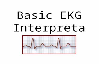 Basic EKG Interpretation. What is an EKG? Also called an ECG, it is an electrocardiogram Recording of the heart's electrical activity A series of "waves"