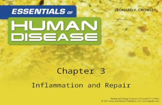 Chapter 3 Inflammation and Repair. Learning Objectives List characteristics and clinical manifestations –Acute inflammation –Types of exudates: serous,