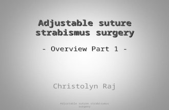 Adjustable suture strabismus surgery - Overview Part 1 - Christolyn Raj Adjustable suture strabisumus surgery.