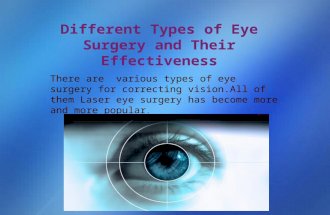 Different Types of Eye Surgery and Their Effectiveness