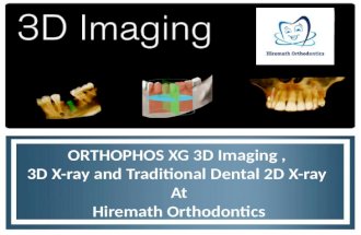 ORTHOPHOS XG 3D Imaging , 3D X-ray and Traditional Dental 2D