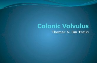 Colonic  Volvulus