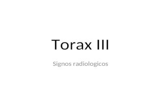 Signos Radiológicos Tórax