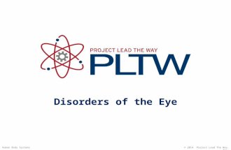 Disorders of the Eye © 2014 Project Lead The Way, Inc.Human Body Systems.