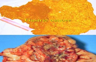 Gastric Cancer 2012