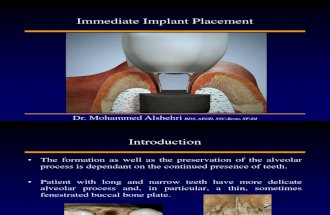 immediateimplantlecture-110518170717-phpapp02
