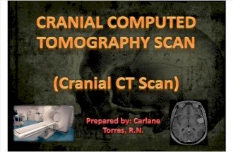 Cranial CT Scan