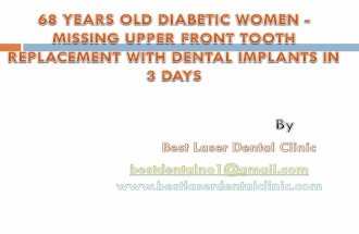 Diabetes and dental implants success rates