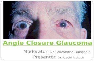 Angle closure glaucoma