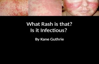 What's Rash is that!