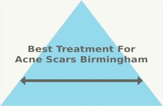 Best Treatment for Acne Scars Birmingham