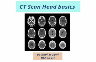 CT Scan Head basics