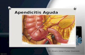 Apendicitis aguda