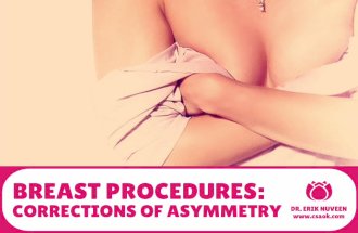 Breast Procedures: Corrections of Asymmetry
