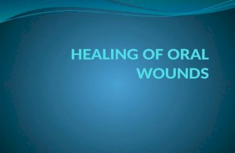 Healing of oral wounds