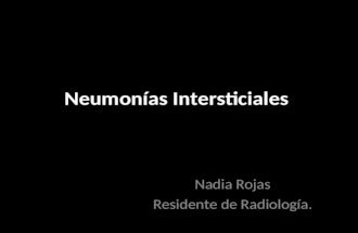 Neumonías intersticiales en tomografía computada.