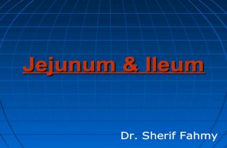 Jejunum & Ileum (Anatomy of the Abdomen)