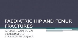 paediatric hip and femur fractures seminar by rv