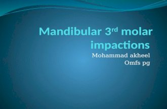 Mandibular 3rd molar impactions