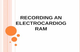 Ppt recording on ecocardiogram