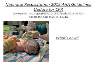 Neonatal resuscitation 2015 aha guidelines update for cpr