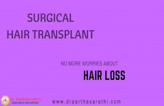 Hair Transplant In Bangalore | Hair Loss Treatment In Bangalore