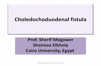Choledochoduodenal fistulas